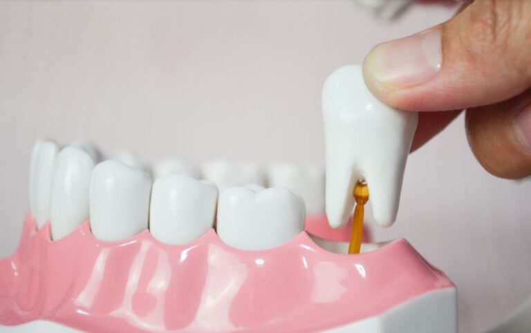 Tooth Extraction: How Long for Hole to Close