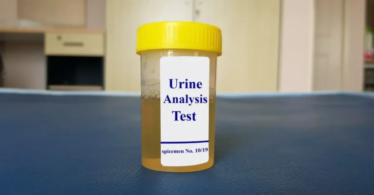 How Long Can Alcohol Be Detected In Urine EtG
