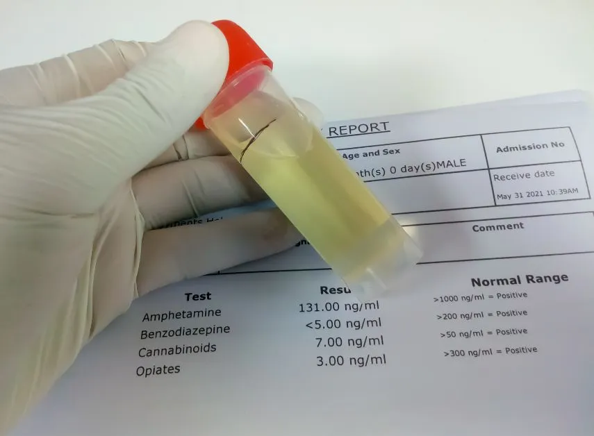 Test for ethanol in urine